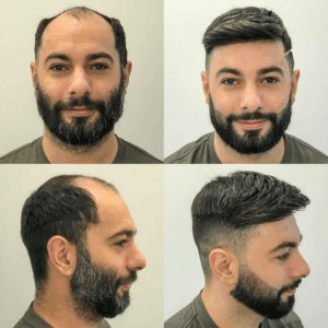Amir men